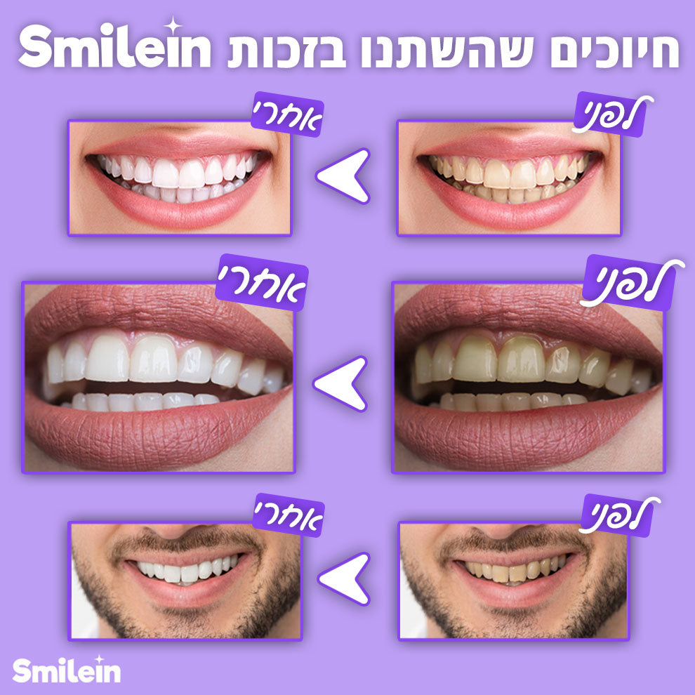SmileIn - מארז להלבנת שיניים
