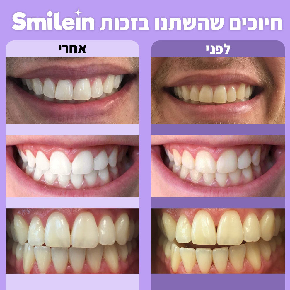SmileIn - מארז להלבנת שיניים