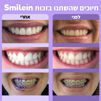SmileIn - מארז להלבנת שיניים
